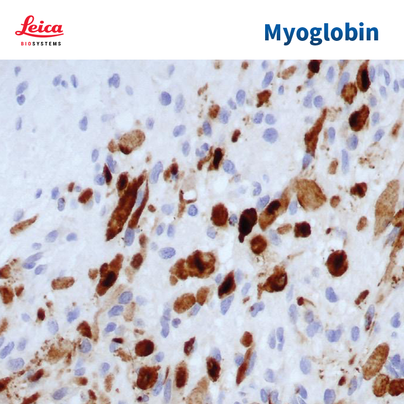 Myoglobin抗体试剂