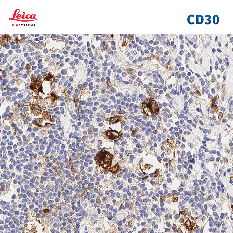CD30抗体试剂