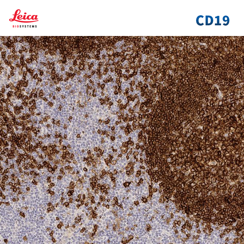 CD19抗体试剂