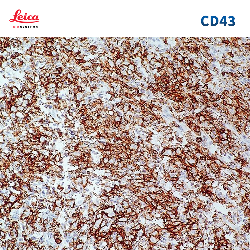 CD43抗体试剂
