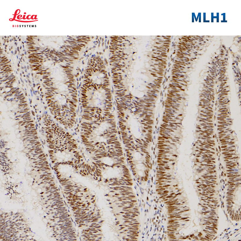 MLH1抗体试剂