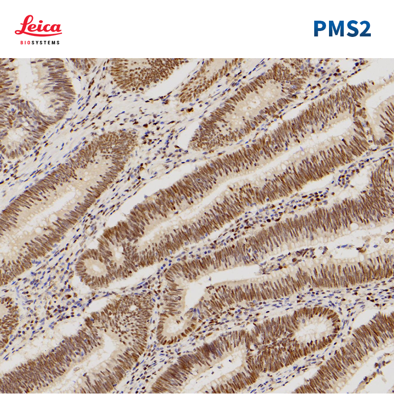 PMS2抗体试剂