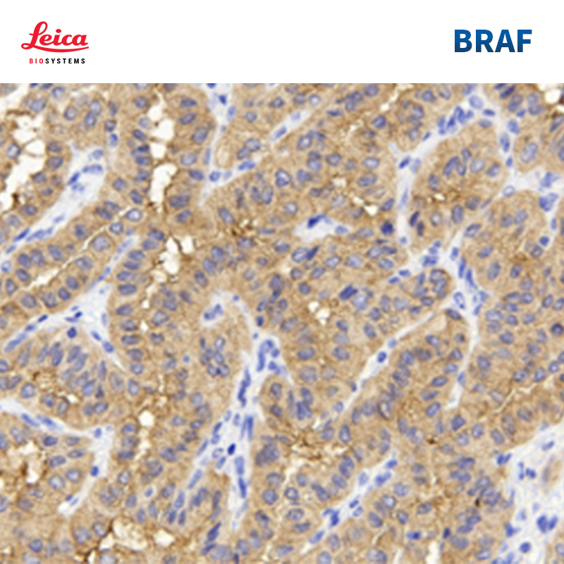 BRAF V600E抗体试剂