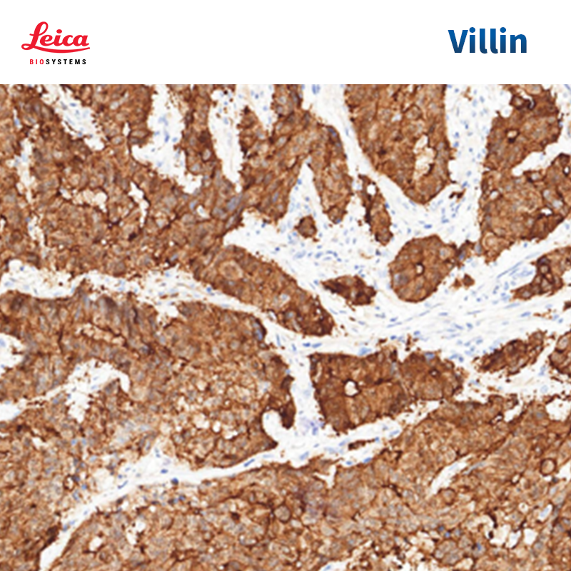 绒毛蛋白（Villin）抗体试剂