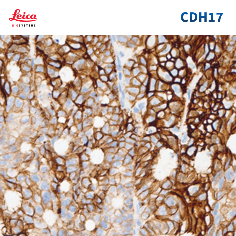 钙黏附蛋白17（Cadherin 17）抗体试剂