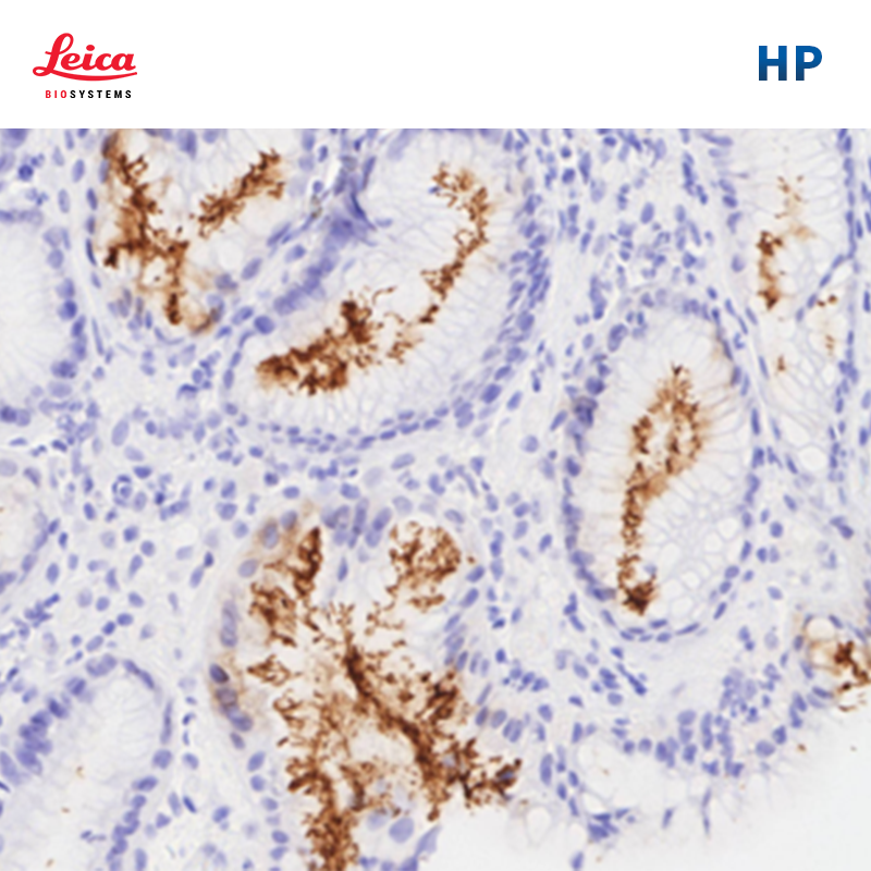 幽门螺旋杆菌（Helicobacter pylori）抗体试剂