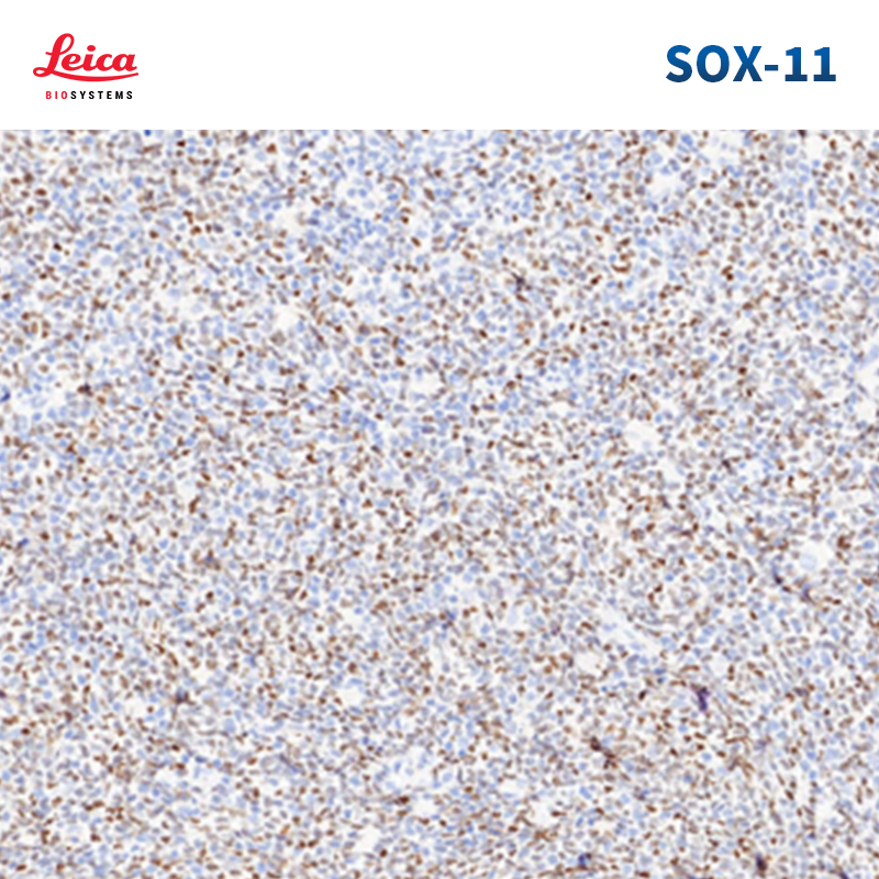 SOX-11抗体试剂