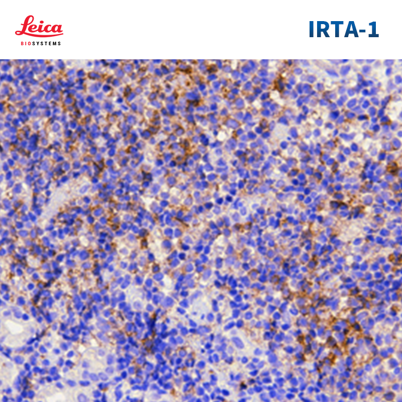 FCRL4（IRTA1）抗体试剂