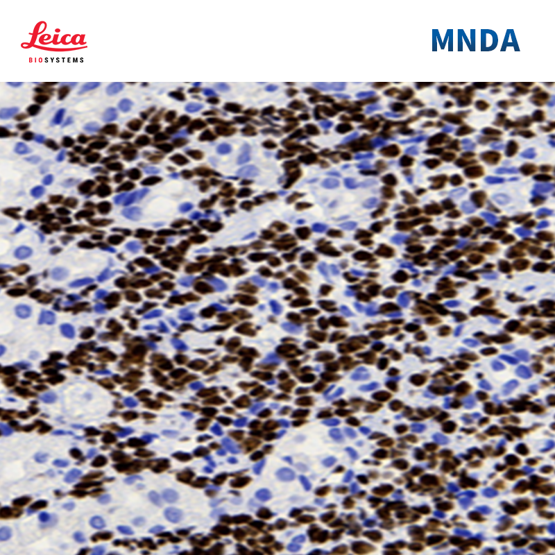 MNDA抗体试剂
