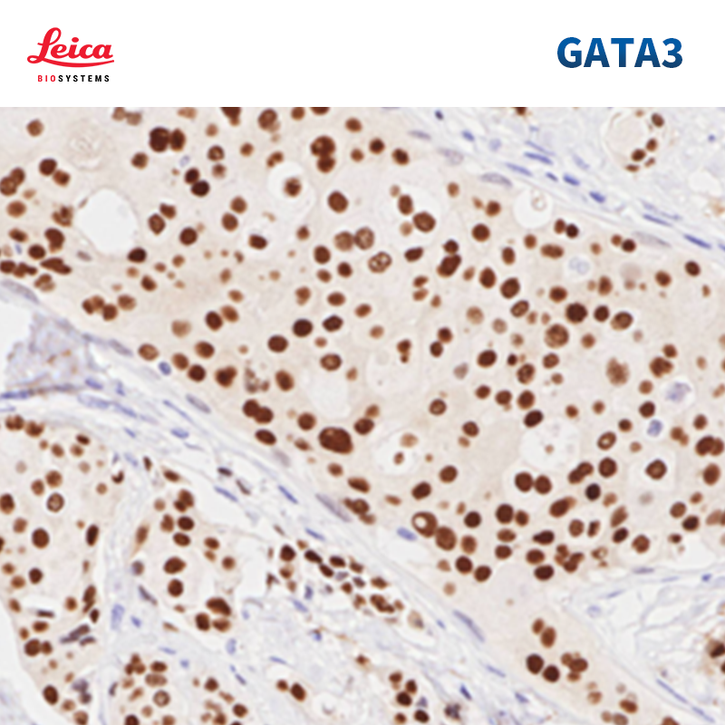 GATA结合蛋白3（GATA3）抗体试剂