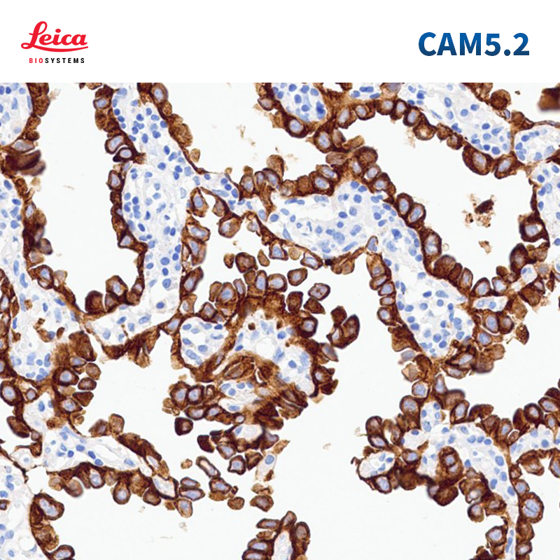 细胞角蛋白CAM5.2抗体试剂（免疫组织化学法）