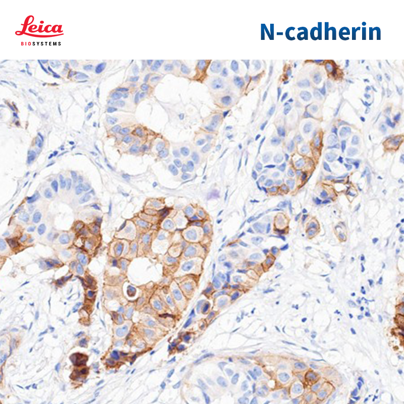 N-钙黏附蛋白（N-cadherin）抗体试剂（免疫组织化学法）