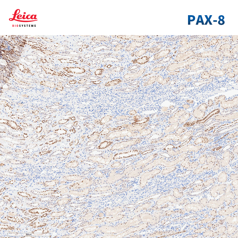 Pax-8抗体试剂
