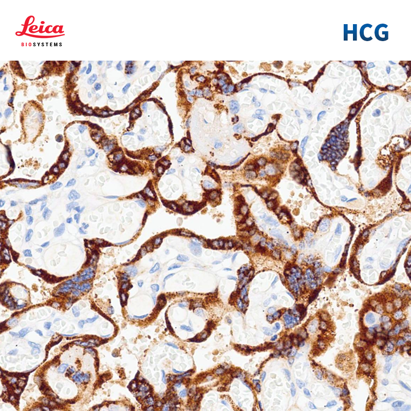 人绒毛膜促性腺激素（HCG）抗体试剂