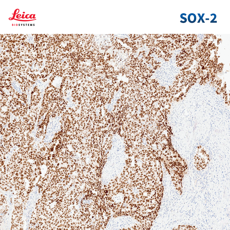 SOX-2抗体试剂（免疫组织化学法）