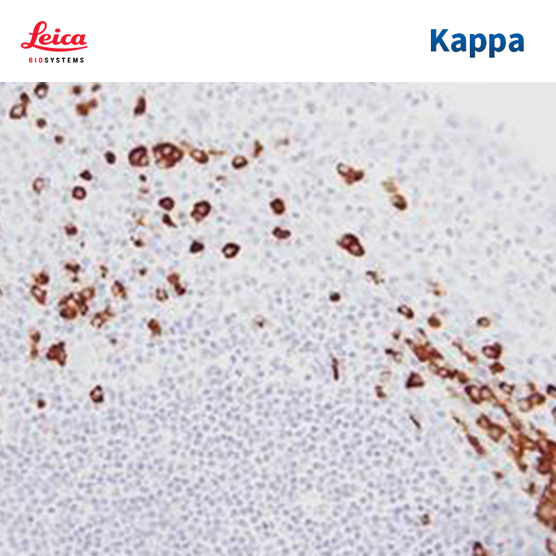 Kappa链探针试剂