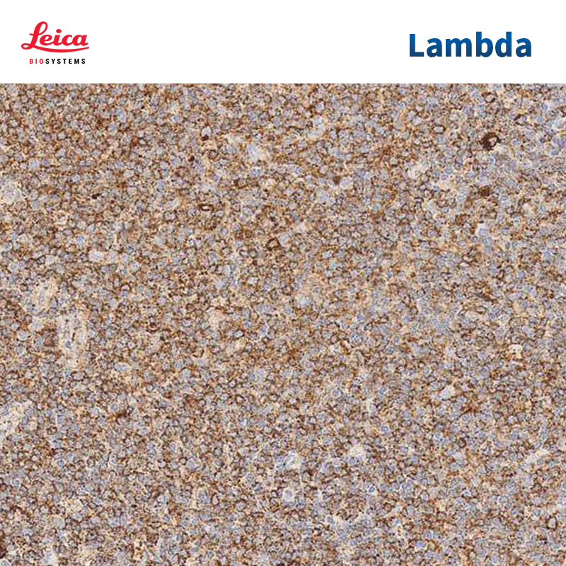 Lambda链探针试剂